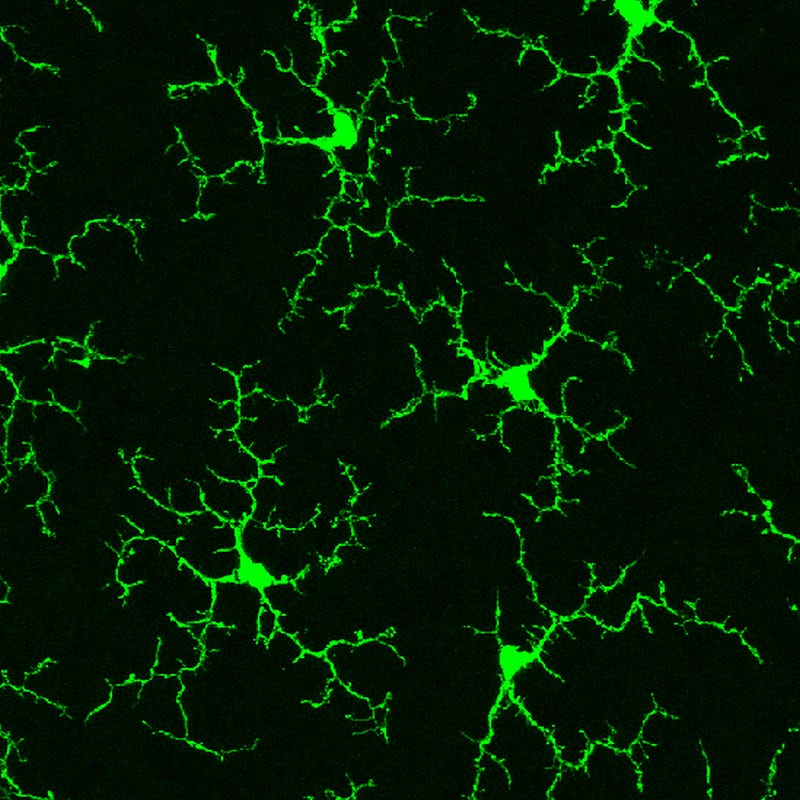 Microglia's Role in Brain Health