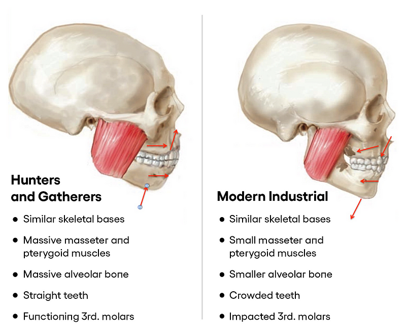 Evolution of skull shapes over time